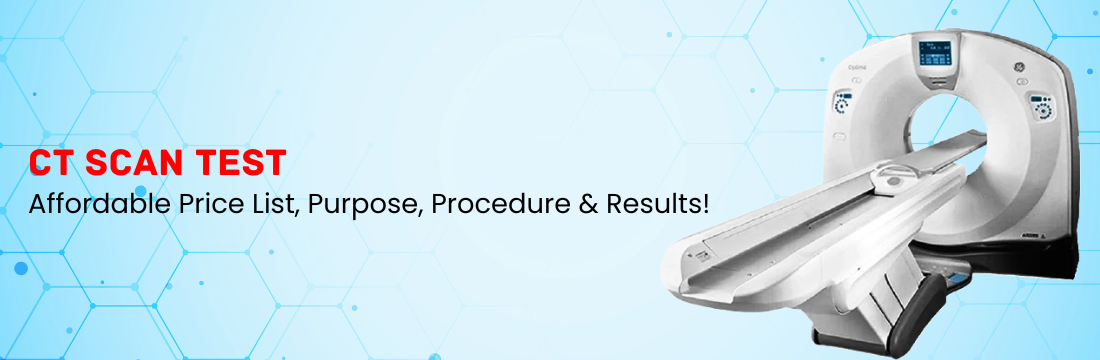 CT Scan Test – Affordable Price List, Purpose, Procedure And Results!